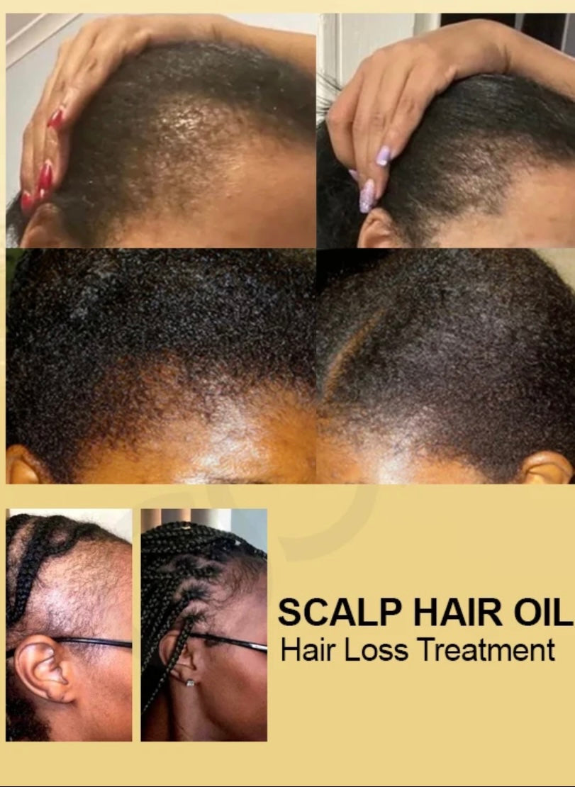 Hair Growth Oil